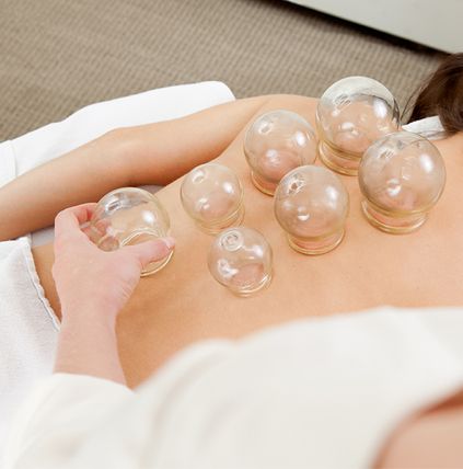 Cupping